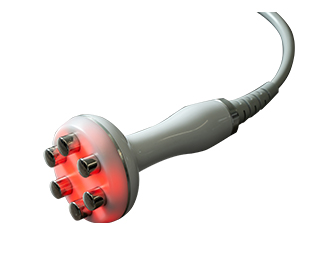 マルチポーララジオ波